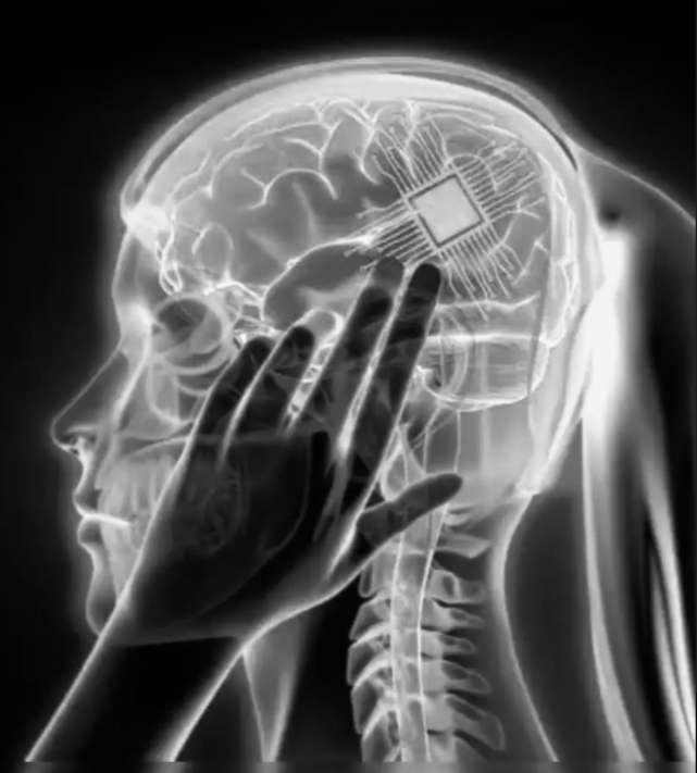 wireless brain chip in a human